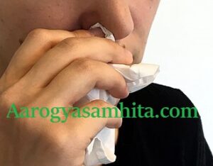 Common Cold - How To Cure A Sneezing In One Day?