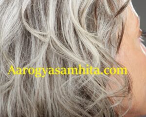 Gray Hair Home Remedies. How to Make White Hair Black Naturally Without Dye?